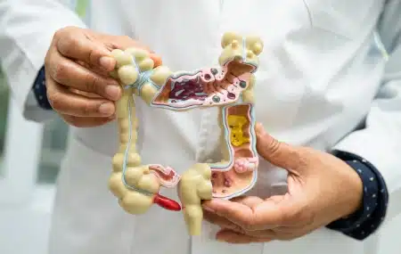 A Potential Link Between Gut Bacteria and Epilepsy