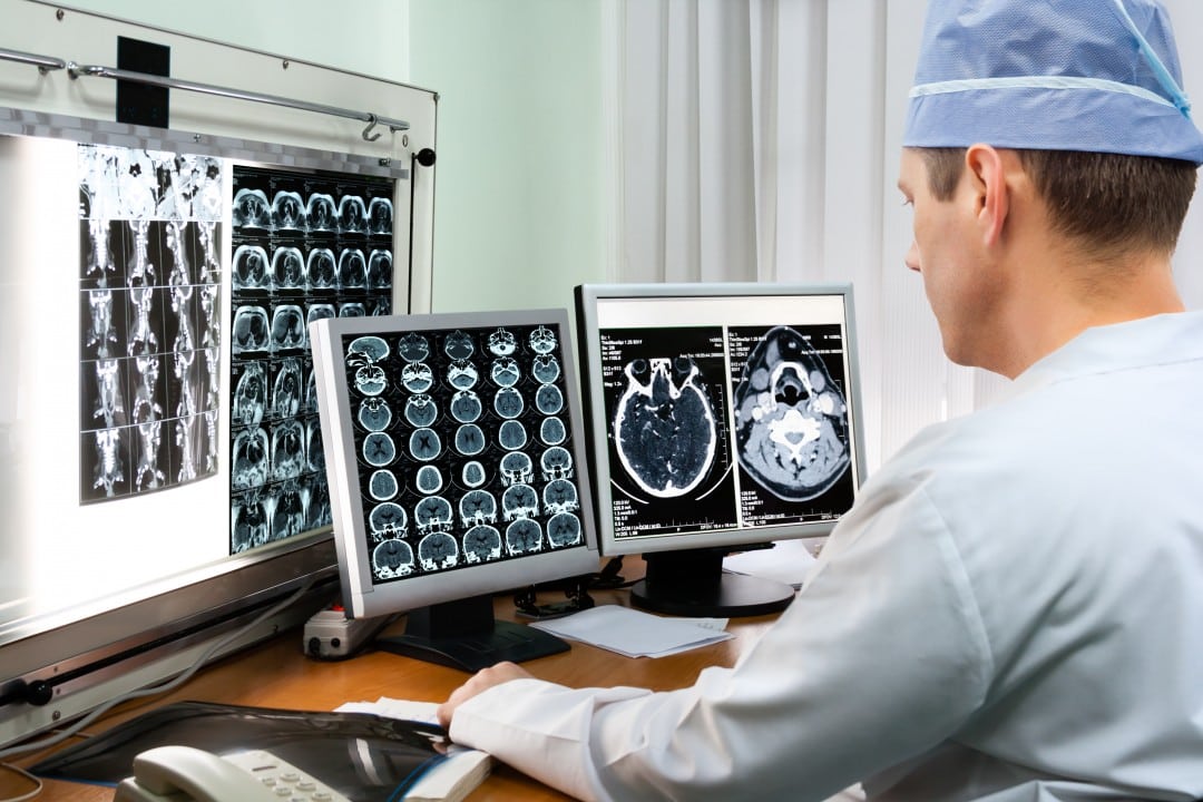 A male doctor in scrubs analyzing brain scans on his computer.