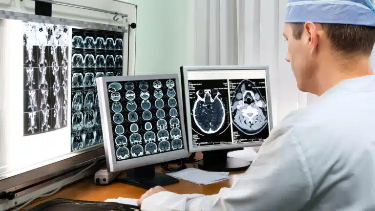 What Causes Epilepsy?