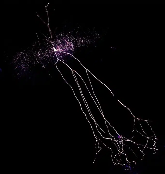 An Interneuron