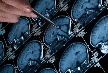 Brain scan images in a grid with a hand pointing to one scan using a pen.