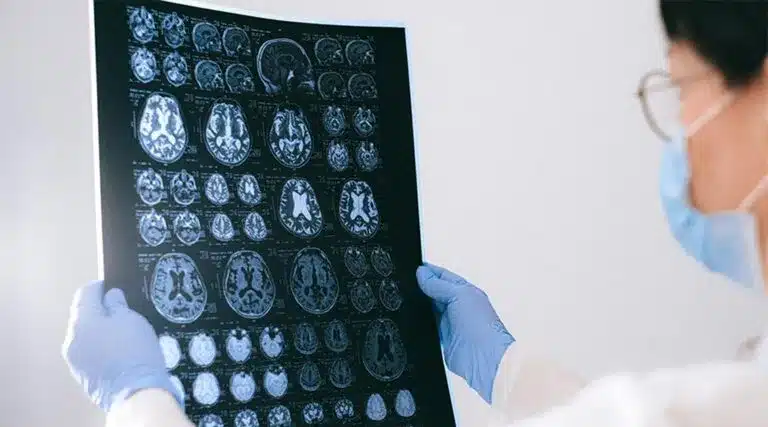 A doctor holding up an x-ray of a brain