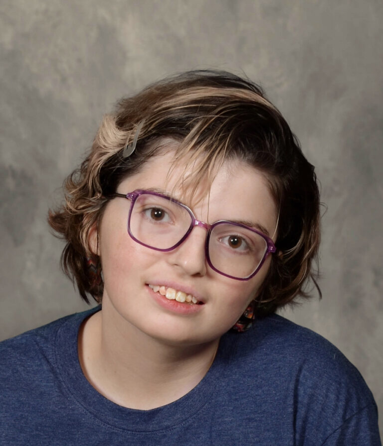 photo of epilepsy patient alexa young woman smiling