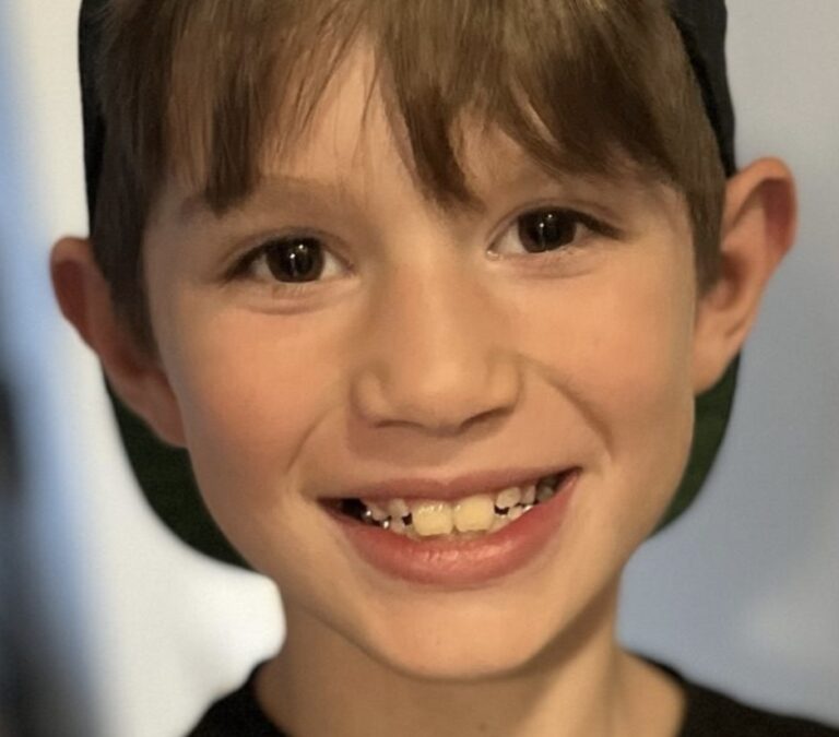 Atticus' Story – CURE Epilepsy