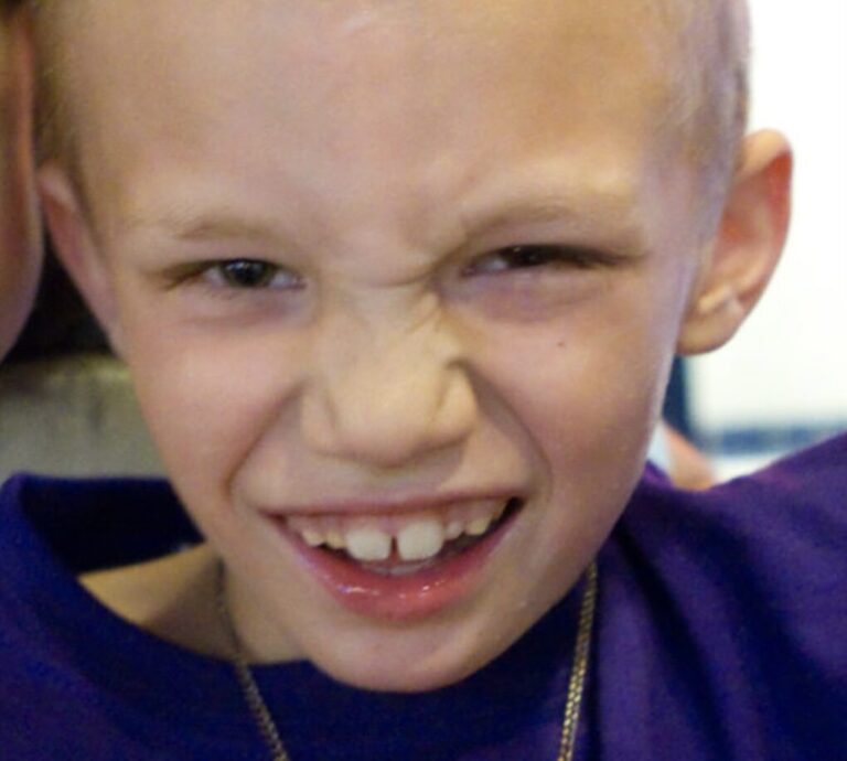 A close-up photo of a boy smiling widely at the camera.