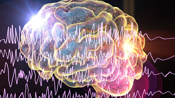 Epilepsy,Awareness,Concept.,Brain,And,Encephalography,In,Epilepsy,Patient,During
